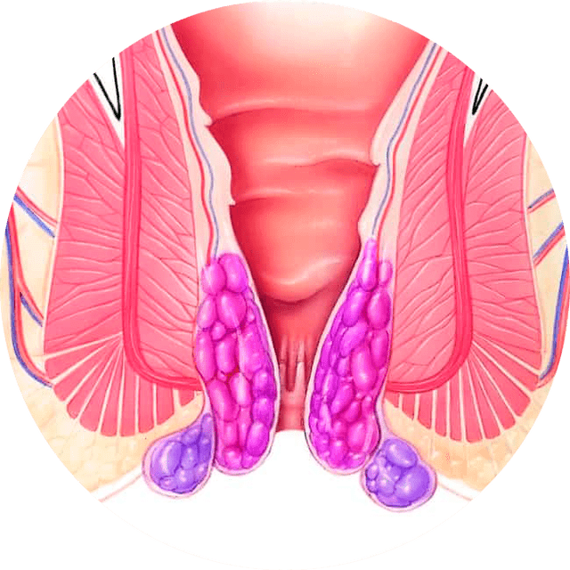 Gelarex zmírňuje příznaky již od prvního použití